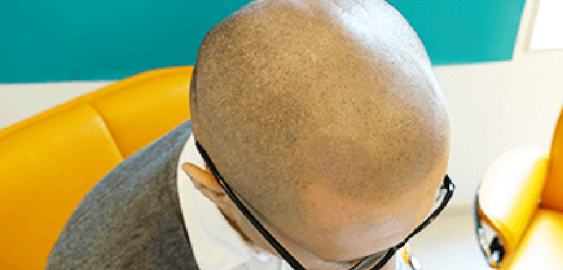 2回目以降の施術